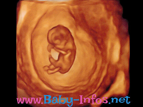 Ultraschallbilder eines Embryos mittels 3D Sonographie