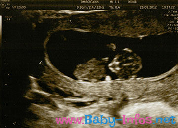 Ultraschallbild 11. Schwangerschaftswoche